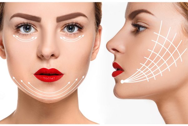 Thread Lift in Melbourne: The Non-Surgical Face Lift You’ve Been Waiting For