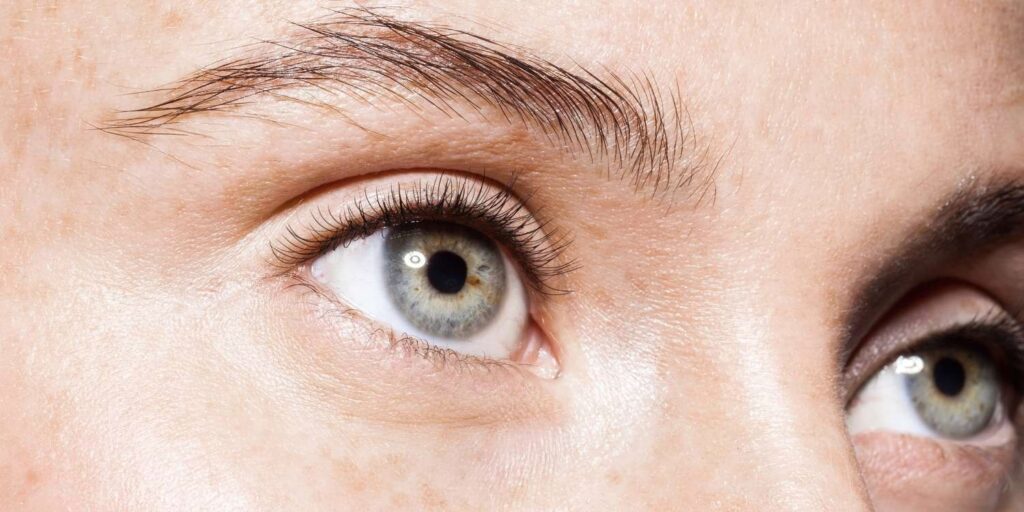 Banish Dark Eye Circles with Proven Solutions for a Fresh Look Dark eye circles removal