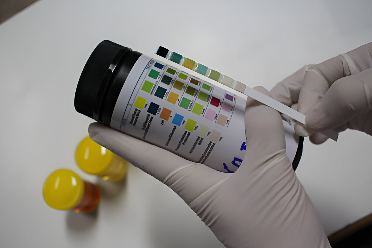 How the 12-Panel Drug Test Works?