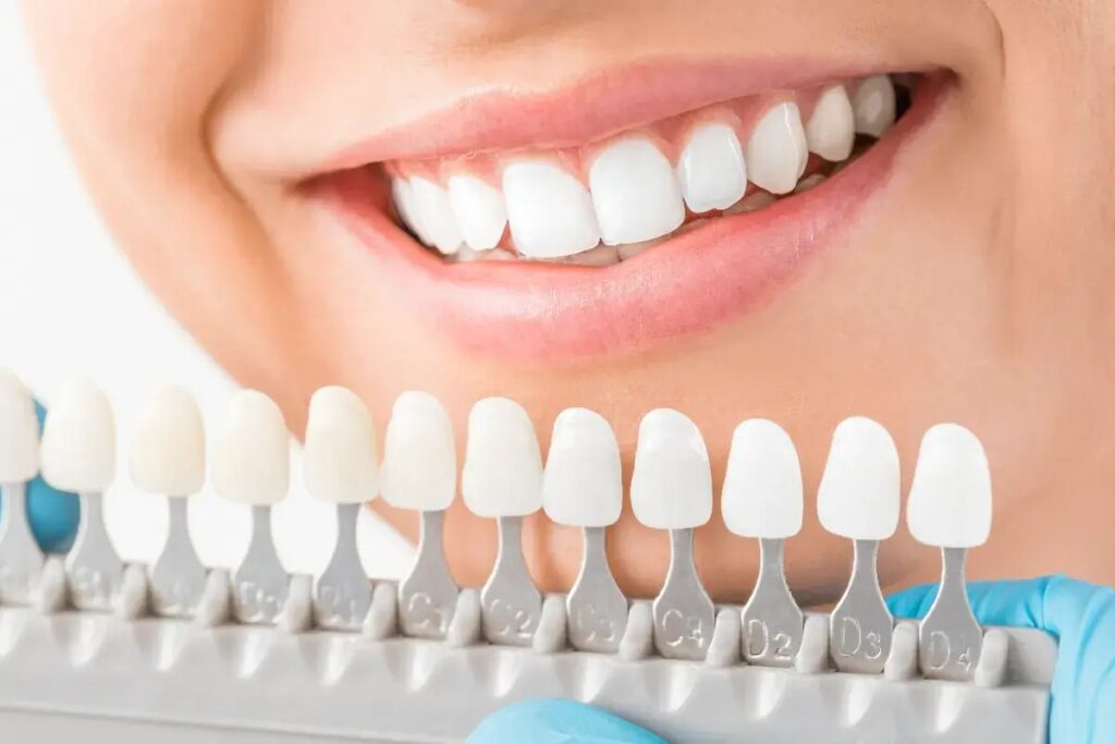 Teeth Whitening: Pros, Cons, and Alternatives