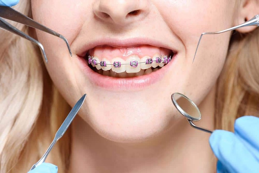 What Does an Orthodontist Do? A Comprehensive Guide to Orthodontic Care