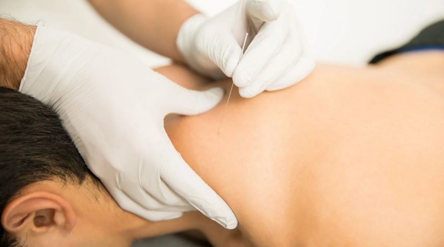 Trigger Point Needling for Headaches and Neck Pain: A Holistic Option