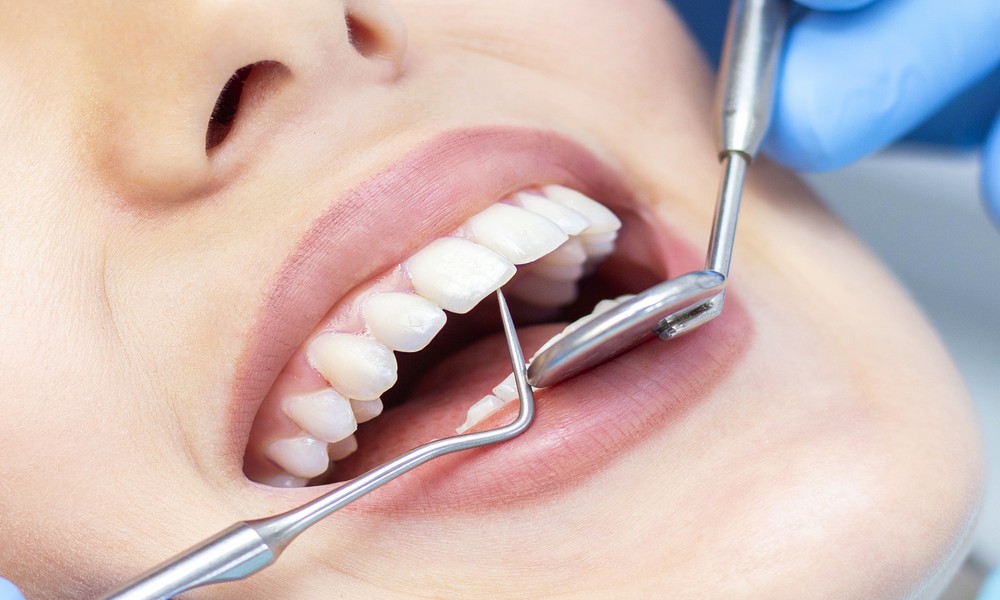 Signs It May Be Time to Visit an Orthodontic Specialist