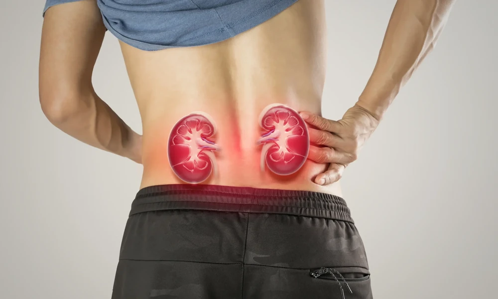 Understanding The Stages Of Chronic Kidney Disease