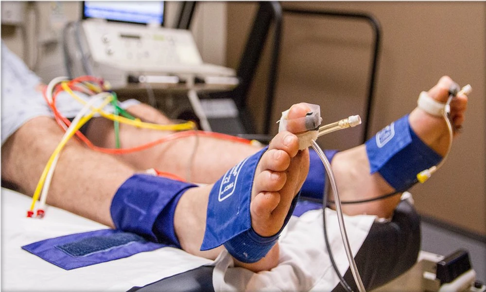 Excellent Ways of Treating Peripheral Artery Disease