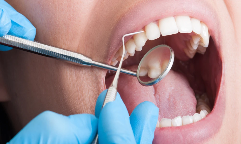 The Difference Between A Pediatric Dental Exam And A Cleaning